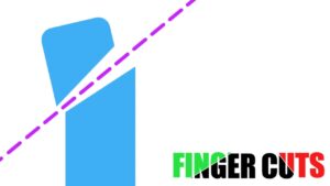 割伤手指 Finger Cuts-游戏白嫖网